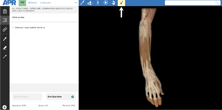 View of APR quiz screen. Specimen is posterior view of superficial muscles of forearm and hand. The quiz question asks the user to click on the extensor carpi radialis muscle.